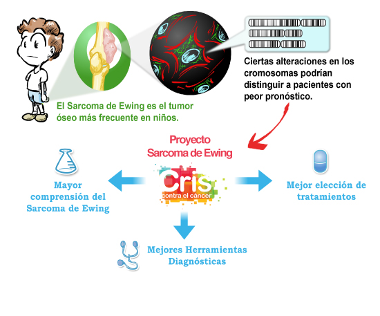 Sarcoma-Ewing2