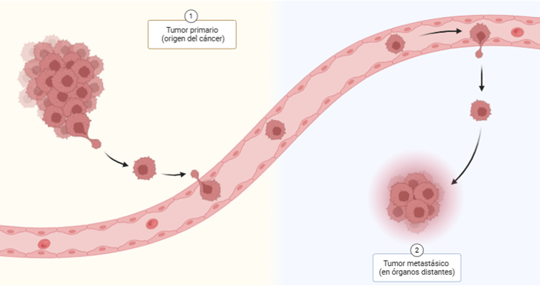 tumor metastásico