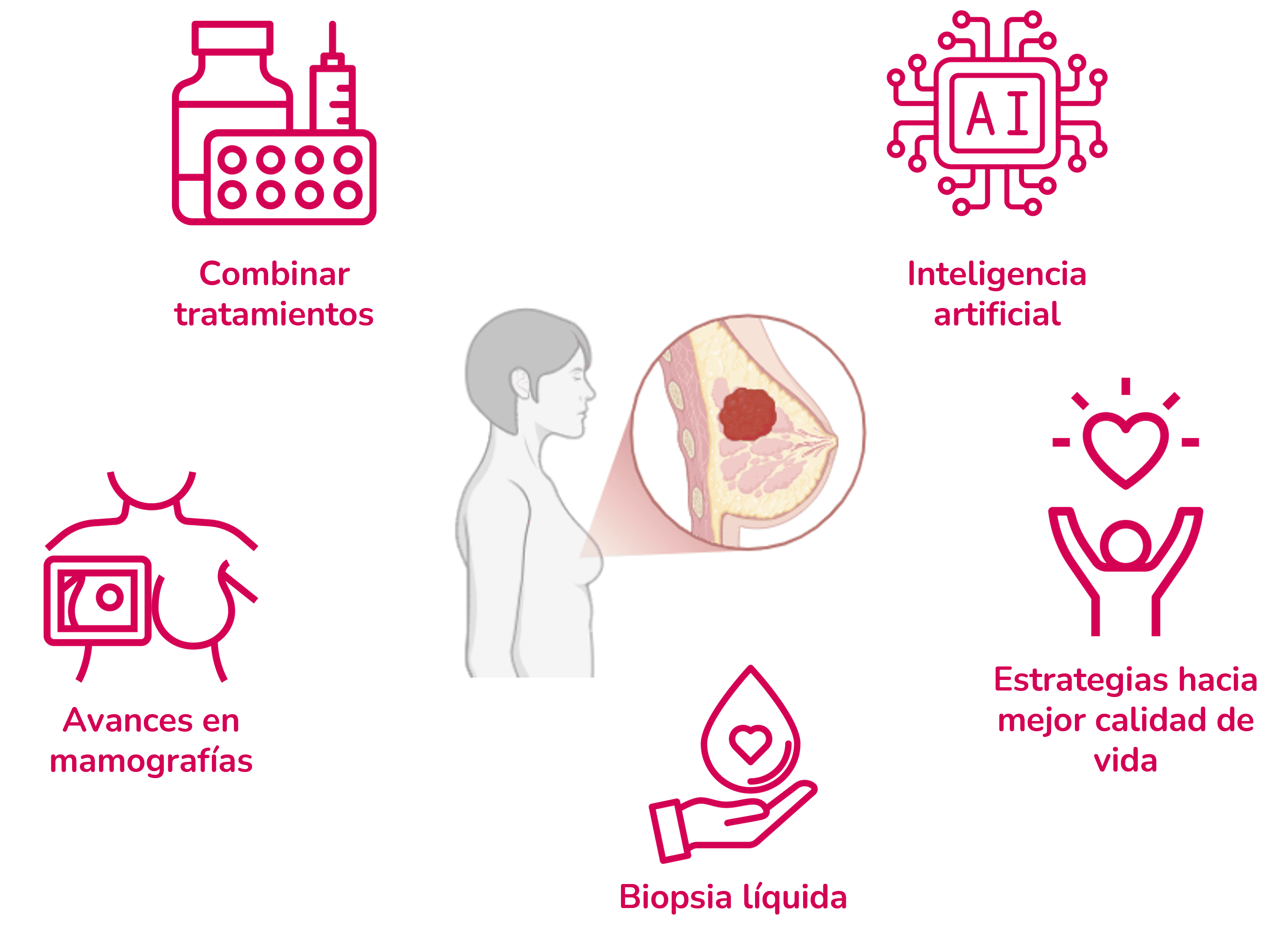 origen del sarcoma