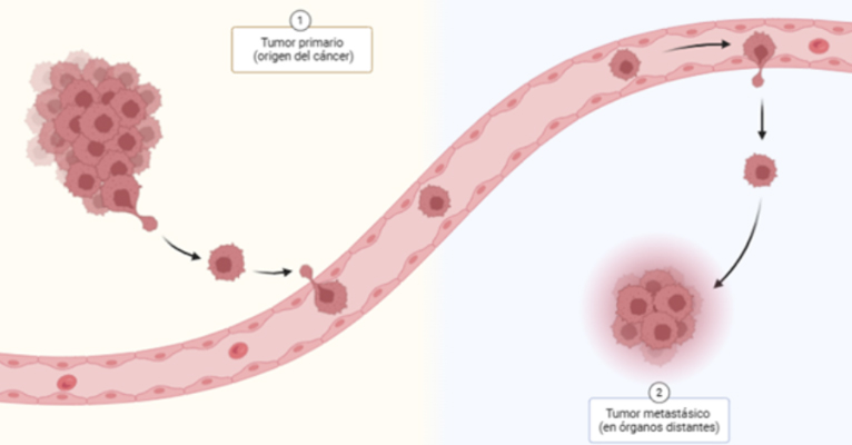 tumor metastásico