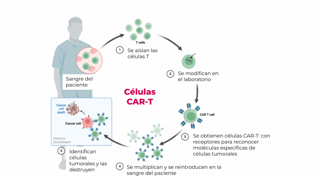 Fases del tratamiento Car T
