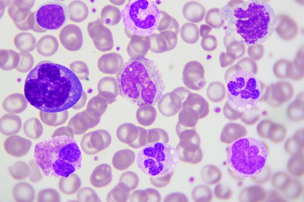 celulas en sangre